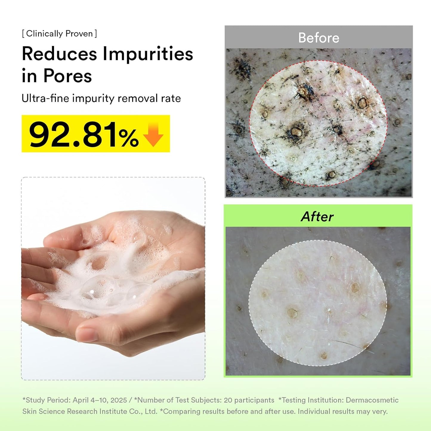 Skinwise™ Pore Clay Pack Cleanser - Heartleaf Charcoal Foam 120ML