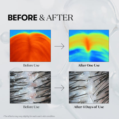 PDRN Micro-Needle Hair Regrowth Ampoule