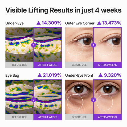 Skinwise 360° PDRN Lifting & Firming Eye Cream