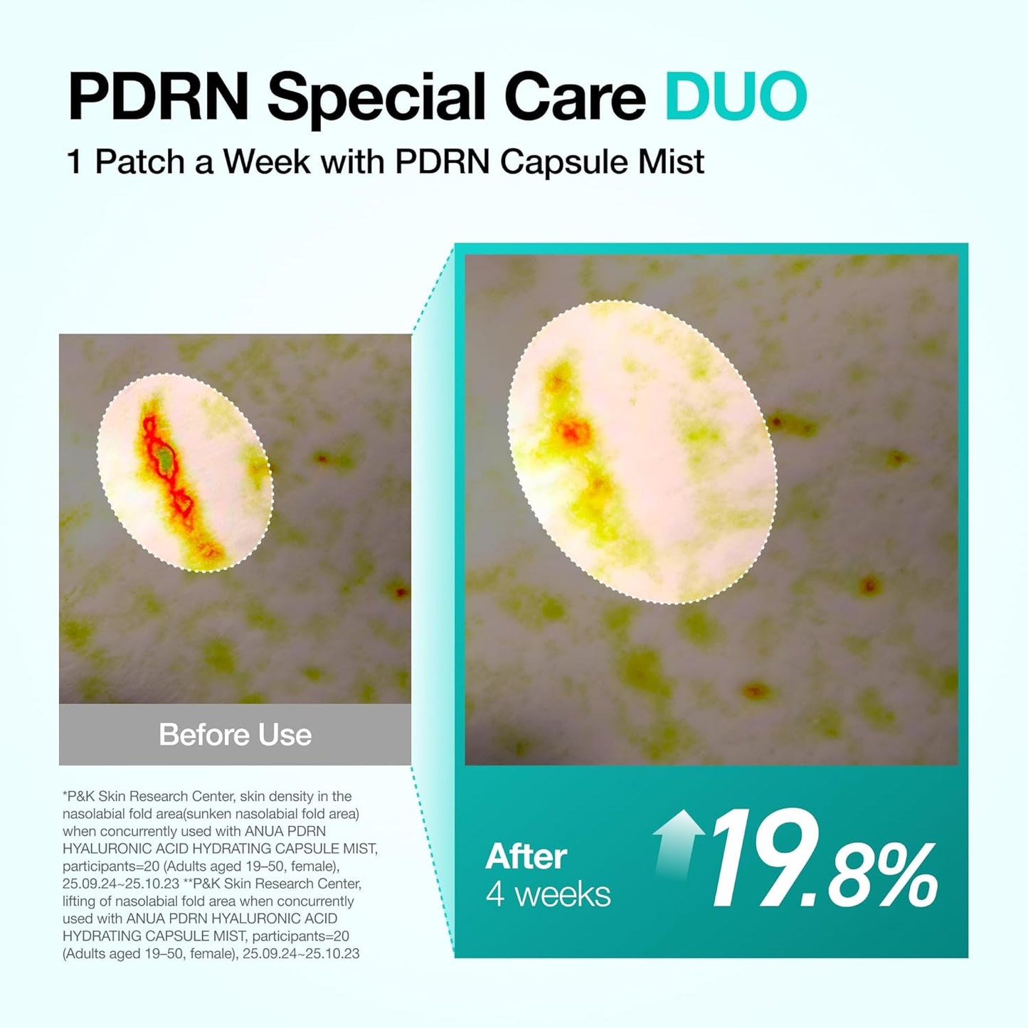 Skinwise™ Korean Glass Skin Duo(SPRAY & PATCHES)