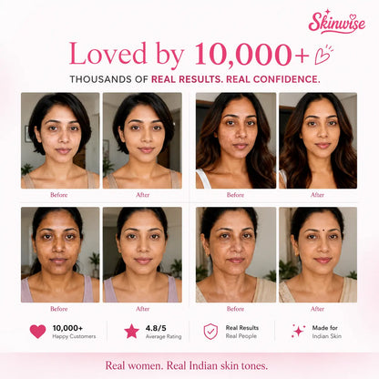 SKINWISE Colour Adapting Foundation