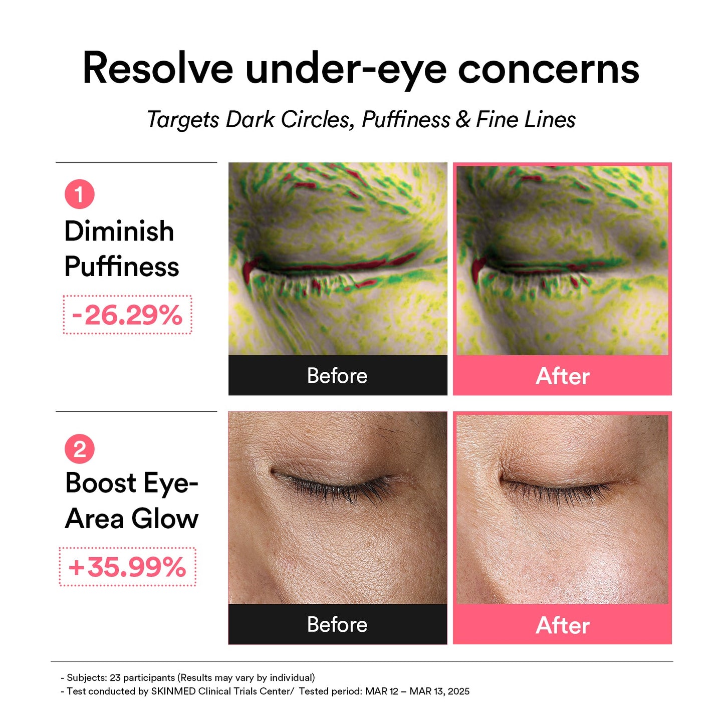 Skinwise™ PDRN retinal eye patch Glow jelly - 60 Patches