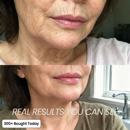 PDRN Pink Collagen Volume Multi Balm
