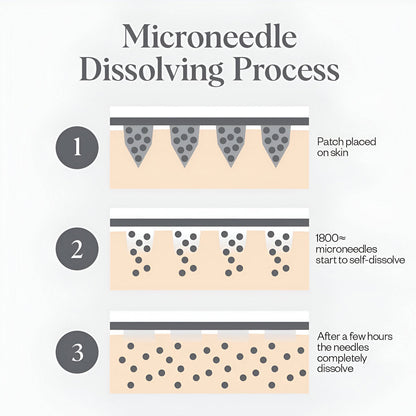 Skinwise™  Micro needle Eye patches