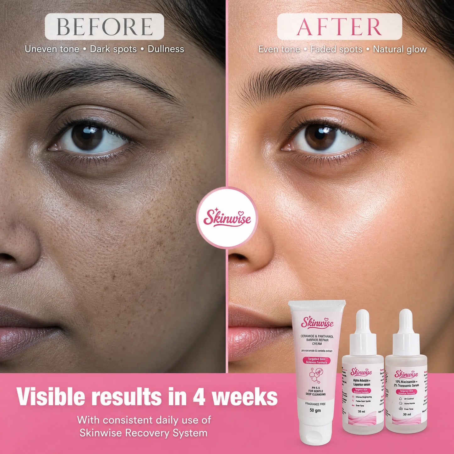Pigmentation Recovery System — 3-Step Combo Kit