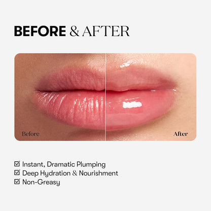 Skinwise™ Lip plumper - EXTREME
