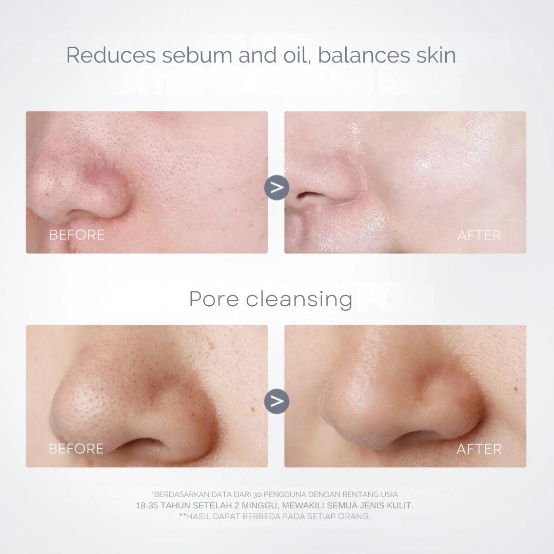 Pore-Away Clay Stick