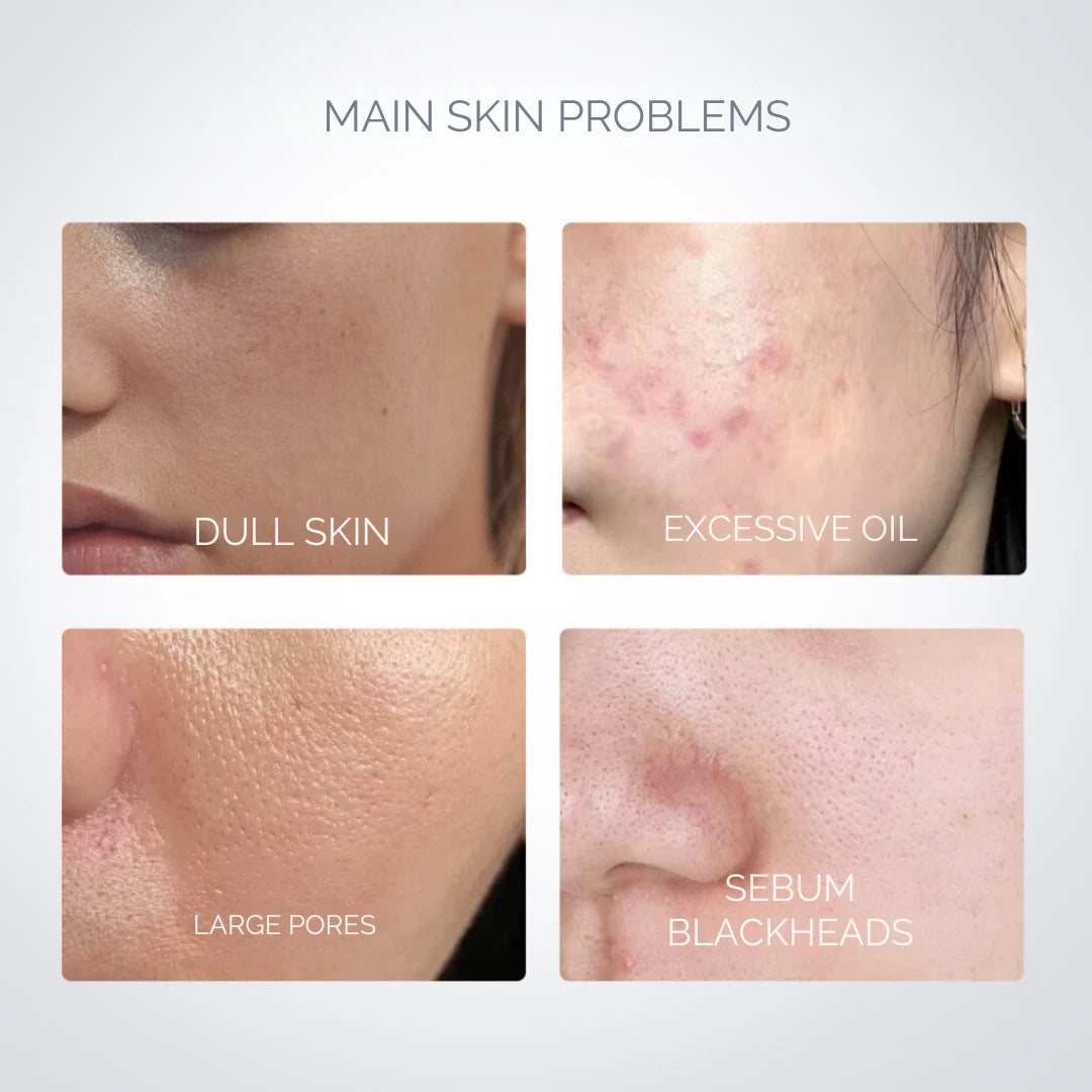 Pore-Away Clay Stick