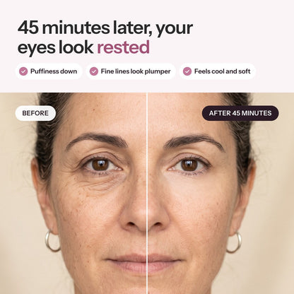 Skinwise™ 3-in-1 Collagen Eye Mask